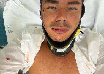 Poetto, pestato a sangue per un orologio: aggredito influencer 30 enne