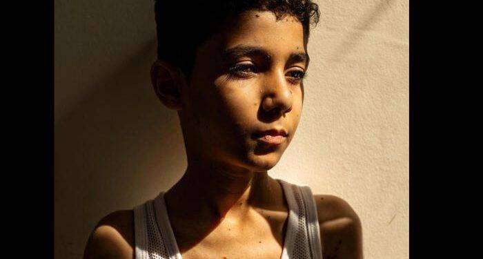 World Press Photo, il bambino amputato a Gaza è la foto dell’anno